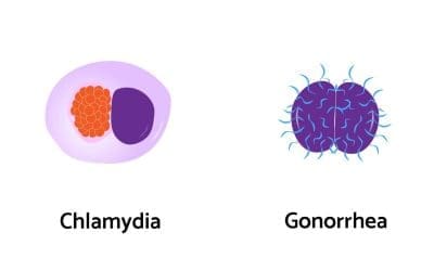 Chlamydia and Gonorrhea: Symptoms & Tests