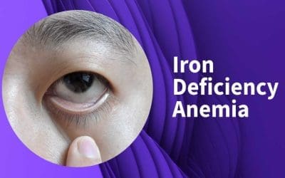 Iron Deficiency Anemia: A Silent Energy Thief