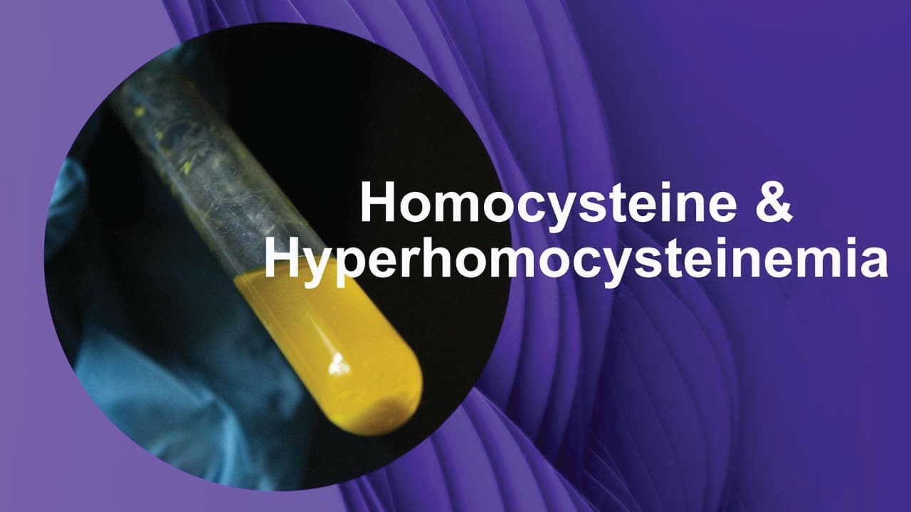 Understanding Homocysteine & Hyperhomocysteinemia