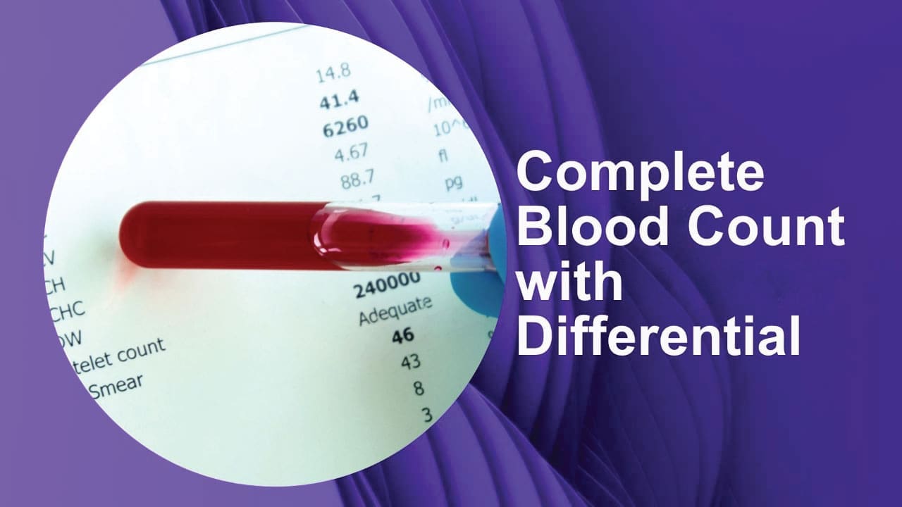 Decoding CBC with Differential