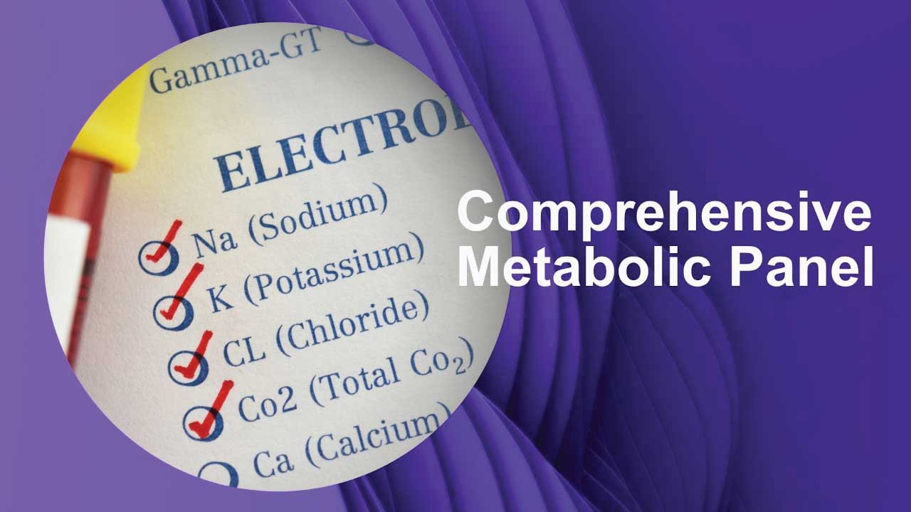 The Comprehensive Metabolic Panel – CMP