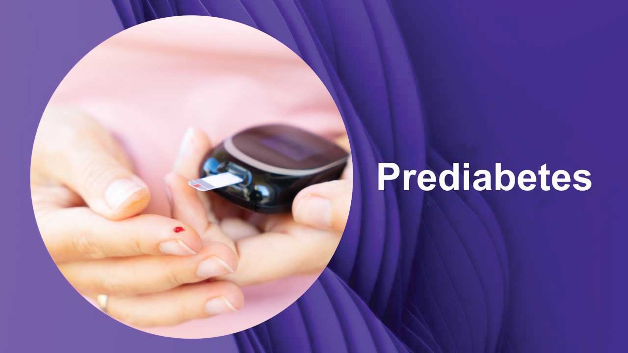 Prediabetes: A Guide to Prevention and Management