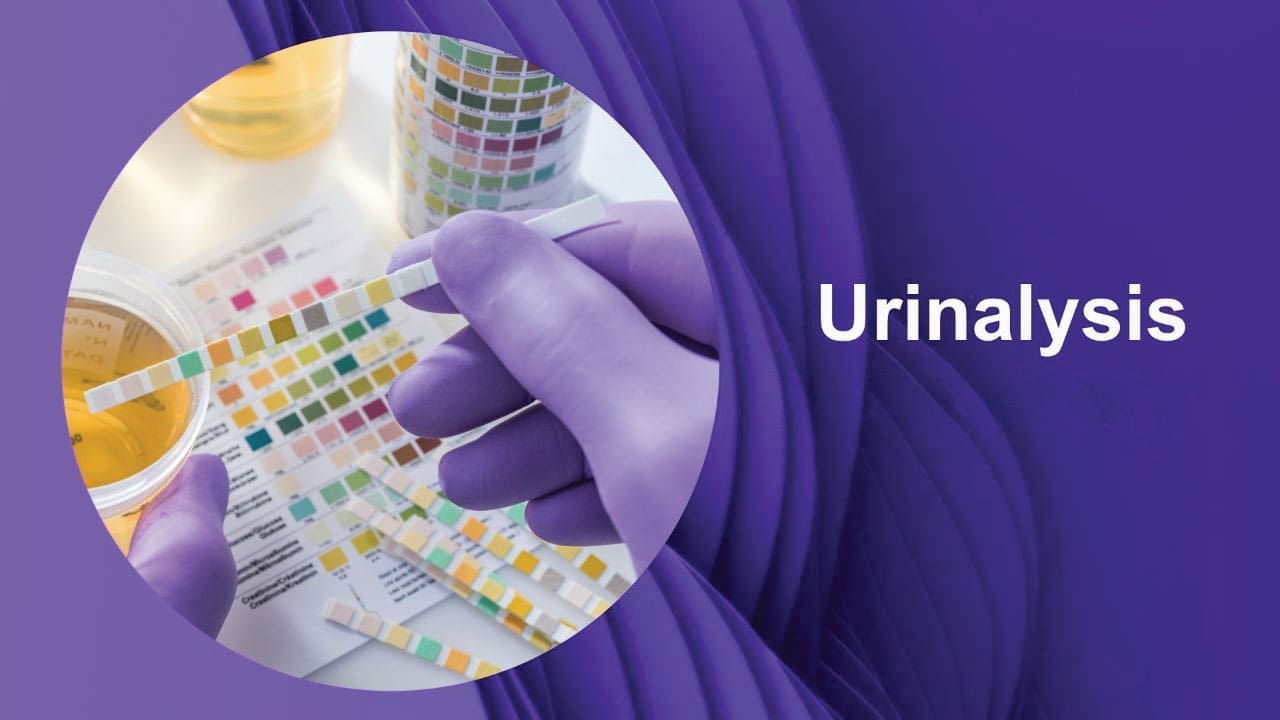 Understanding Your Urinalysis: A Clinical Guide for Women